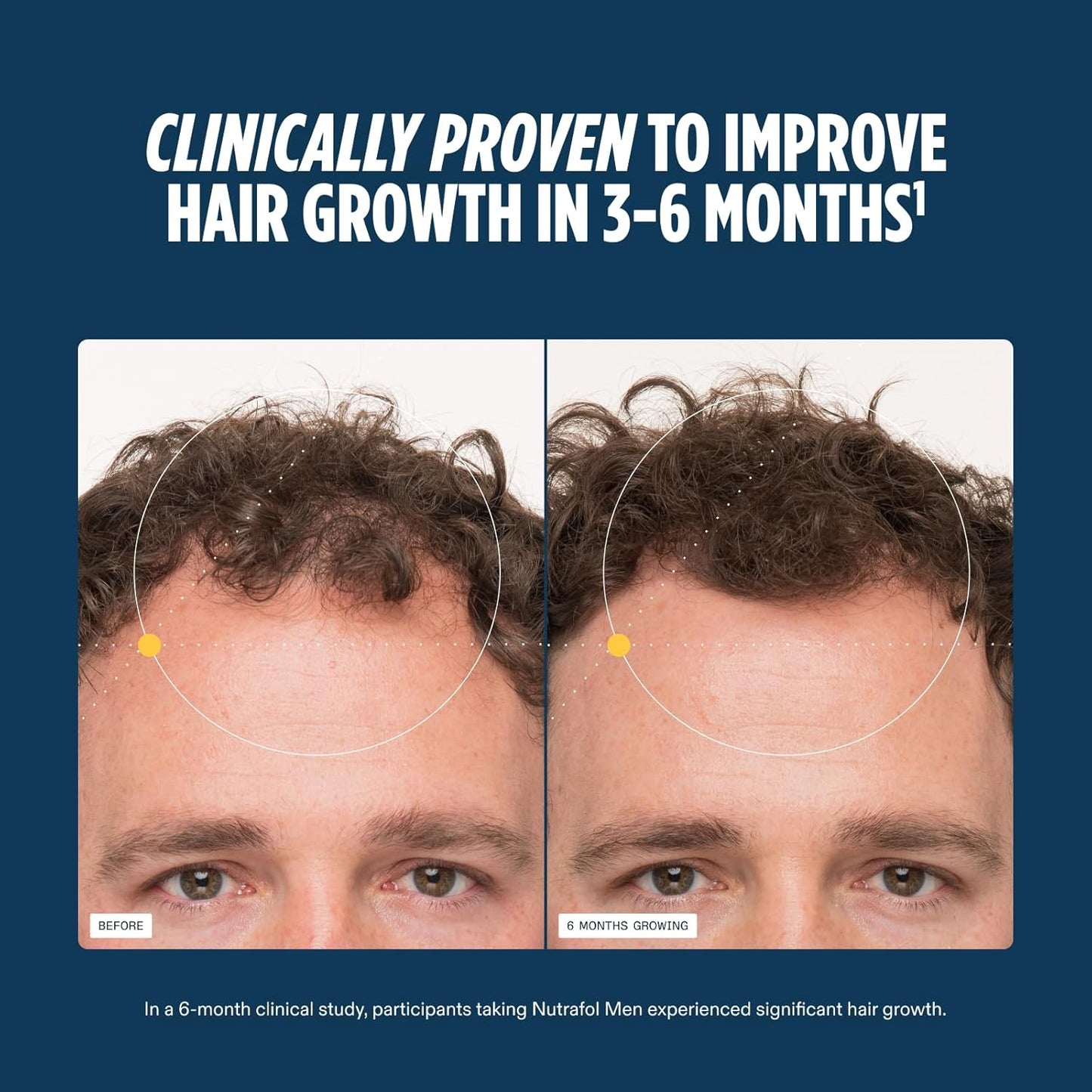 Nutrafol Men's Hair Growth Supplements